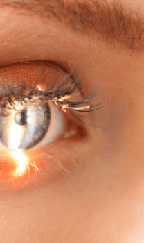 cirugia refractiva